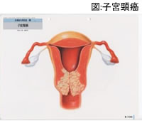 浮腫の鑑別疾患